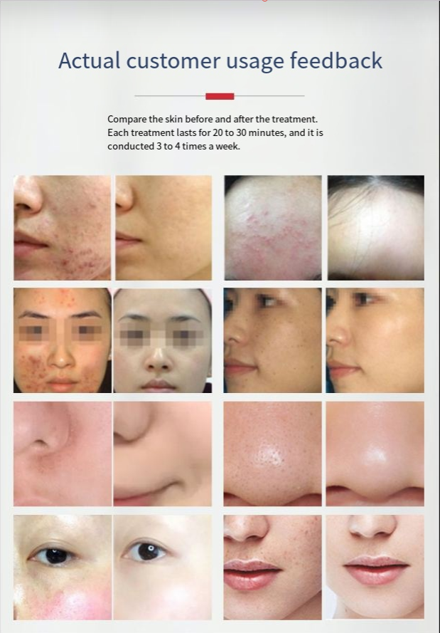 LED Light Therapy Face Mask | 7 Color Skin Rejuvenation